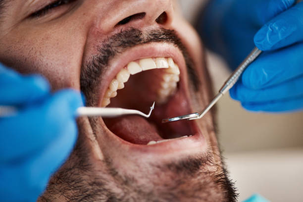 Best Emergency Dental Care for Broken or Chipped Teeth in Sunray, TX
